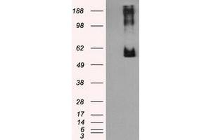HEK293T cells were transfected with the pCMV6-ENTRY control (Left lane) or pCMV6-ENTRY LIPG (Right lane) cDNA for 48 hrs and lysed. (LIPG antibody)
