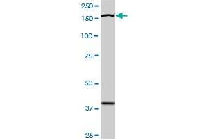 Western Blotting (WB) image for anti-TEK Tyrosine Kinase, Endothelial (TEK) (AA 66-185) antibody (ABIN793004) (TEK antibody  (AA 66-185))