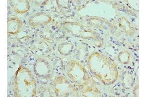 Immunohistochemistry of paraffin-embedded human kidney tissue using ABIN7145331 at dilution of 1:100 (BNIP3 antibody  (AA 1-164))