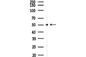 Western blot analysis of lysates from K562 cells(UV 30 min treatment), using Cytochrome P450 17 Antibody at 1/1000 dilution.