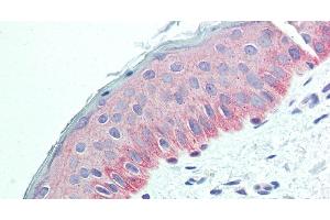 Immunohistochemistry of paraffin-embedded Human Skin using NECTIN4 Polyclonal Antibody at dilution of 1:90. (PVRL4 antibody)