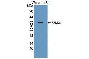 Western Blotting (WB) image for anti-N-Acetyl alpha-D-Glucosaminidase (AA 485-743) antibody (ABIN1869393) (N-Acetyl alpha-D-Glucosaminidase (AA 485-743) antibody)