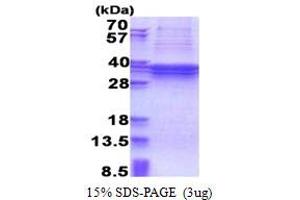 SDS-PAGE (SDS) image for TBC1 (Tre-2/USP6, BUB2, Cdc16) Domain Family, Member 1 (TBC1D1) (AA 1-265) protein (His tag) (ABIN5853350)
