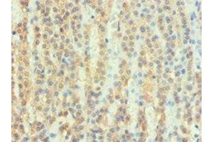 Immunohistochemistry of paraffin-embedded human adrenal gland tissue using ABIN7167679 at dilution of 1:100 (ATP6AP2 antibody  (AA 251-350))