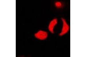 Immunofluorescent analysis of PP1 beta staining in U2OS cells. (Serine/threonine-Protein Phosphatase PP1-beta Catalytic Subunit (PP1-BETA) antibody)