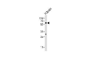 Western blot analysis of lysate from human brain tissue lysate, using ZN Antibody (C-term) (ABIN6242707 and ABIN6577591). (ZNF610 antibody  (C-Term))