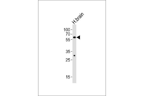 ZNF610 anticorps  (C-Term)