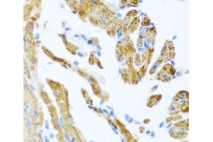 Immunohistochemistry of paraffin-embedded Mouse heart using COL9A3 Polyclonal Antibody at dilution of 1:100 (40x lens).