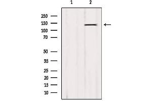 Western blot analysis of extracts from B16F10, using QSK Antibody. (SIK3 antibody  (Internal Region))