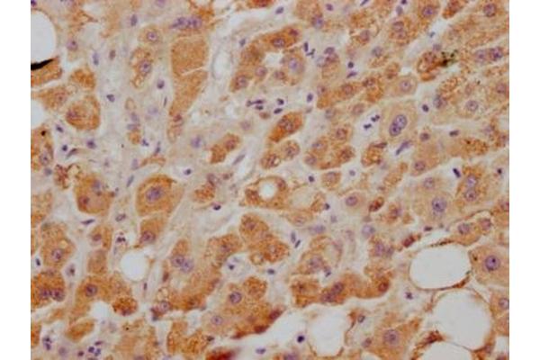 Recombinant NPC1L1 antibody