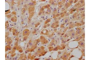 IHC image of ABIN7127645 diluted at 1:100 and staining in paraffin-embedded human liver tissue performed on a Leica BondTM system. (Recombinant NPC1L1 antibody)