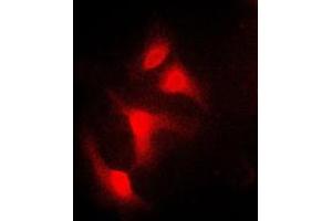 Immunofluorescent analysis of IKB alpha staining in HeLa cells. (NFKBIA antibody  (N-Term))