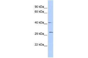 WB Suggested Anti-ZFP36 Antibody Titration:  0. (ZFP36 antibody  (Middle Region))