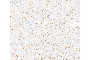 Immunohistochemistry (IHC) image for anti-SWI/SNF Related, Matrix Associated, Actin Dependent Regulator of Chromatin, Subfamily A, Member 2 (SMARCA2) (AA 100-150) antibody (ABIN7795711)