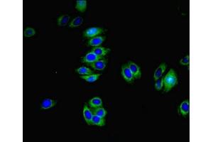 Immunofluorescent analysis of HepG2 cells using ABIN7173277 at dilution of 1:100 and Alexa Fluor 488-congugated AffiniPure Goat Anti-Rabbit IgG(H+L) (TMEM82 antibody  (AA 168-202))