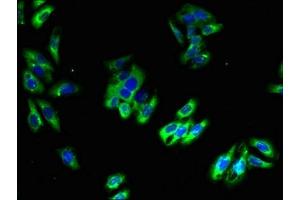 Immunofluorescent analysis of HepG2 cells using ABIN7163548 at dilution of 1:100 and Alexa Fluor 488-congugated AffiniPure Goat Anti-Rabbit IgG(H+L) (Plasmolipin antibody  (AA 1-35))