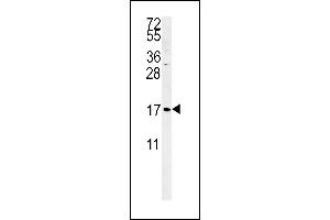 SGP Antibody (Center)&65288,Cat(ABIN651464 and ABIN2840255)&65289,western blot analysis in K562 cell line lysates (35 μg/lane). (SMAGP antibody  (AA 46-75))