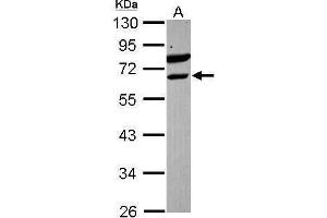 WB Image Sample (30 ug of whole cell lysate) A: Raji 10% SDS PAGE antibody diluted at 1:1000 (ETV6 antibody)