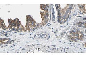 ABIN6272548 at 1/100 staining Human prostate tissue by IHC-P. (AK8 antibody  (Internal Region))