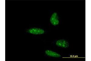 Immunofluorescence of monoclonal antibody to ATOH1 on HeLa cell. (ATOH1 antibody  (AA 266-354))