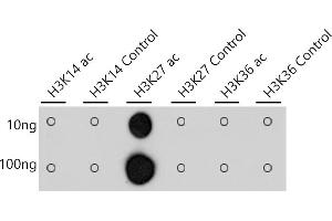 Dot-blot analysis of all sorts of peptides using Acetyl-Histone H3-K27 antibody (ABIN3016650, ABIN3016651, ABIN3016652, ABIN1682513 and ABIN1682514) at 1:1000 dilution. (Histone 3 antibody  (acLys27))