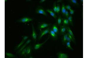 Immunofluorescent analysis of Hela cells using ABIN7152944 at dilution of 1:100 and Alexa Fluor 488-congugated AffiniPure Goat Anti-Rabbit IgG(H+L) (Filamin A antibody  (AA 1234-1462))