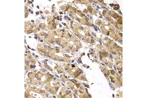 Immunohistochemistry of paraffin-embedded human gastric injury using ASMTL antibody. (ASMTL antibody  (AA 1-290))