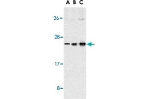 Western blot analysis of TNFSF13 expression in Jurkat cells with TNFSF13 polyclonal antibody  at 1 ug/mL (A), 2 ug/mL (B), and 4 ug/mL (C). (TNFSF13 antibody  (C-Term))