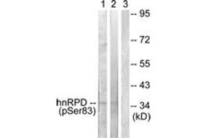Western blot analysis of extracts from HuvEc and 293 cells, using hnRPD (Phospho-Ser83) Antibody.
