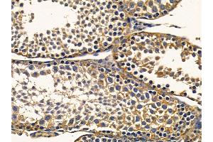 ABIN7094212 and ABIN7098258 at 1/100 staining mouse testis tissue by IHC-P.