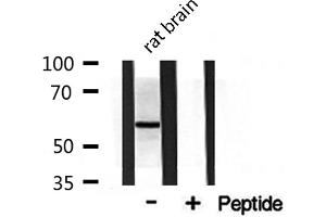 Western blot analysis on rat brain lysate using DOK3 Antibody (DOK3 antibody  (Internal Region))