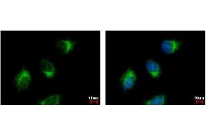 ICC/IF Image GGA3 antibody [C3], C-term detects GGA3 protein at Golgi apparatus by immunofluorescent analysis. (GGA3 antibody  (C-Term))