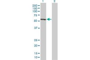 Western Blot analysis of EPB41 expression in transfected 293T cell line by EPB41 MaxPab polyclonal antibody. (EPB41 antibody  (AA 1-720))