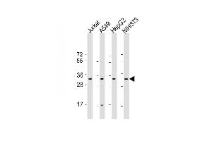 All lanes : Anti-RPS2 Antibody (C-Term) at 1:2000 dilution Lane 1: Jurkat whole cell lysate Lane 2: A549 whole cell lysate Lane 3: HepG2 whole cell lysate Lane 4: NIH/3T3 whole cell lysate Lysates/proteins at 20 μg per lane. (RPS2 antibody  (AA 248-379))