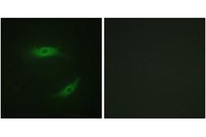 Immunofluorescence analysis of HepG2 cells, using CD4 (Phospho-Ser433) Antibody. (CD4 antibody  (pSer433))
