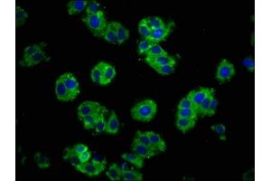 Immunofluorescence staining of HepG2 cells with ABIN7146190 at 1:100, counter-stained with DAPI. (E-cadherin antibody  (AA 153-641))