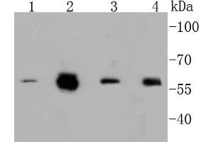 Lane 1: A549, Lane 2: HCT116, Lane 3: Hela, Lane 4: HepG2 cell lysates, probed with c-Myc(S62) (1A7 ) Monoclonal Antibody  at 1:1000 overnight at 4˚C. (c-MYC antibody  (pSer62))