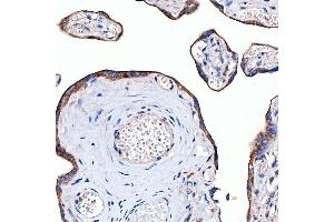 IHC analysis of Rab4/RAB4A using anti-Rab4/RAB4A antibody (ABIN7599733). (Rab4 antibody  (AA 110-216))