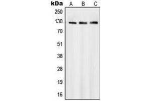 Western blot analysis of SMG7 expression in Jurkat (A), A431 (B), HeLa (C) whole cell lysates.