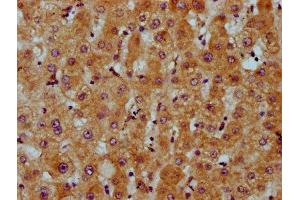 IHC image of ABIN7163112 diluted at 1:200 and staining in paraffin-embedded human liver tissue performed on a Leica BondTM system. (CDS2 antibody  (AA 354-445))