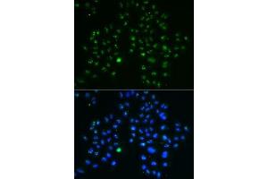 Immunofluorescence analysis of MCF7 cells using GNL3 antibody (ABIN6130343, ABIN6141249, ABIN6141250 and ABIN6222113). (Nucleostemin antibody  (AA 1-240))