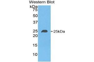 Western Blotting (WB) image for anti-NME/NM23 Nucleoside Diphosphate Kinase 6 (NME6) (AA 3-182) antibody (ABIN1860011) (NME6 antibody  (AA 3-182))