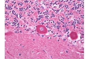 Anti-TRPV3 antibody IHC of human brain, cerebellum, Purkinje.