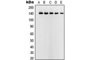 Western blot analysis of USF2 expression in HeLa (A), Jurkat (B), K562 (C), A431 (D), NIH3T3 (E) whole cell lysates. (USF2 antibody  (Center))