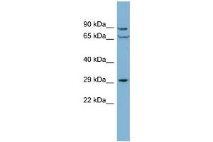 WB Suggested Anti-CUTC  Antibody Titration: 0. (CUTC antibody  (Middle Region))