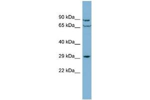 WB Suggested Anti-CUTC  Antibody Titration: 0.