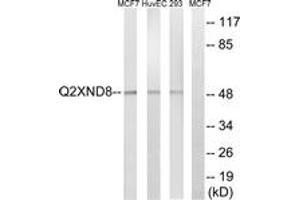 Western blot analysis of extracts from 293/HuvEc/MCF-7 cells, using Cytochrome P450 2D6 Antibody. (CYP2D6 antibody  (AA 41-90))