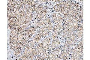 IHC analysis of COPE using anti-COPE antibody (ABIN7602509). (COPE antibody  (AA 80-308))