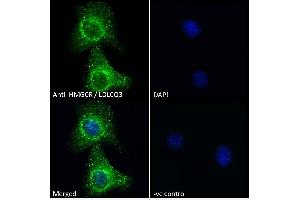 ABIN570699 Immunofluorescence analysis of paraformaldehyde fixed A549 cells, permeabilized with 0. (HMGCR antibody  (Internal Region))