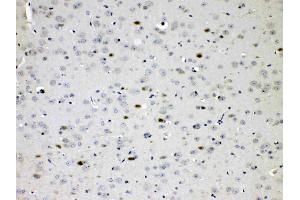 IHC analysis of CHAT using anti- CHAT antibody . (Choline Acetyltransferase antibody  (AA 446-652))